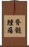 脊髄腫瘍 Scroll