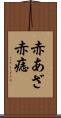 赤あざ Scroll