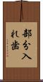 部分入れ歯 Scroll