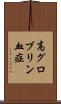 高グロブリン血症 Scroll