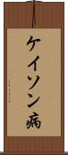 ケイソン病 Scroll