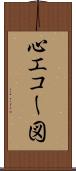 心エコー図 Scroll