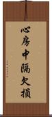 心房中隔欠損 Scroll