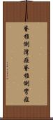 脊椎側湾症 Scroll