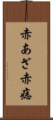 赤あざ Scroll