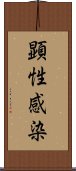 顕性感染 Scroll