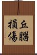 丘腦損傷 Scroll