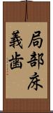 局部床義歯 Scroll