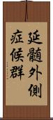 延髄外側症候群 Scroll