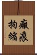 瘢痕拘縮 Scroll