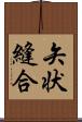 矢状縫合 Scroll