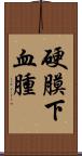 硬膜下血腫 Scroll