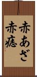 赤あざ Scroll