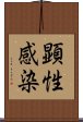 顕性感染 Scroll