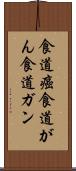 食道癌;食道がん;食道ガン Scroll