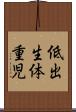 低出生体重児 Scroll