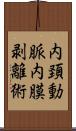 内頚動脈内膜剥離術 Scroll