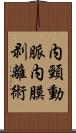 内頸動脈内膜剥離術 Scroll