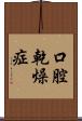 口腔乾燥症 Scroll
