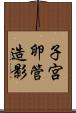 子宮卵管造影 Scroll