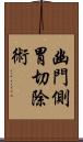 幽門側胃切除術 Scroll