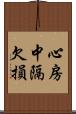 心房中隔欠損 Scroll