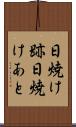 日焼け跡 Scroll