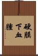 硬膜下血腫 Scroll