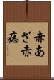 赤あざ Scroll