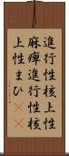 進行性核上性麻痺 Scroll