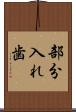 部分入れ歯 Scroll