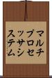 マルチプロセッサ・システム Scroll