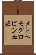 メトヘモグロビン血症 Scroll