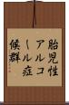 胎児性アルコール症候群 Scroll