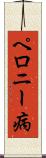 ペロニー病 Scroll