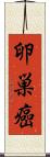 卵巣癌 Scroll