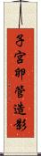 子宮卵管造影 Scroll