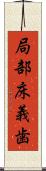 局部床義歯 Scroll