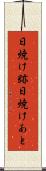 日焼け跡 Scroll