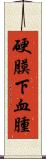 硬膜下血腫 Scroll