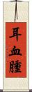 耳血腫 Scroll