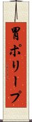 胃ポリープ Scroll