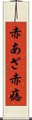 赤あざ Scroll