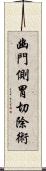 幽門側胃切除術 Scroll