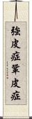 強皮症 Scroll