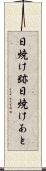 日焼け跡 Scroll