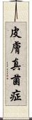 皮膚真菌症 Scroll