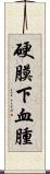 硬膜下血腫 Scroll