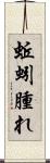 蚯蚓腫れ Scroll
