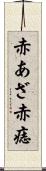 赤あざ Scroll
